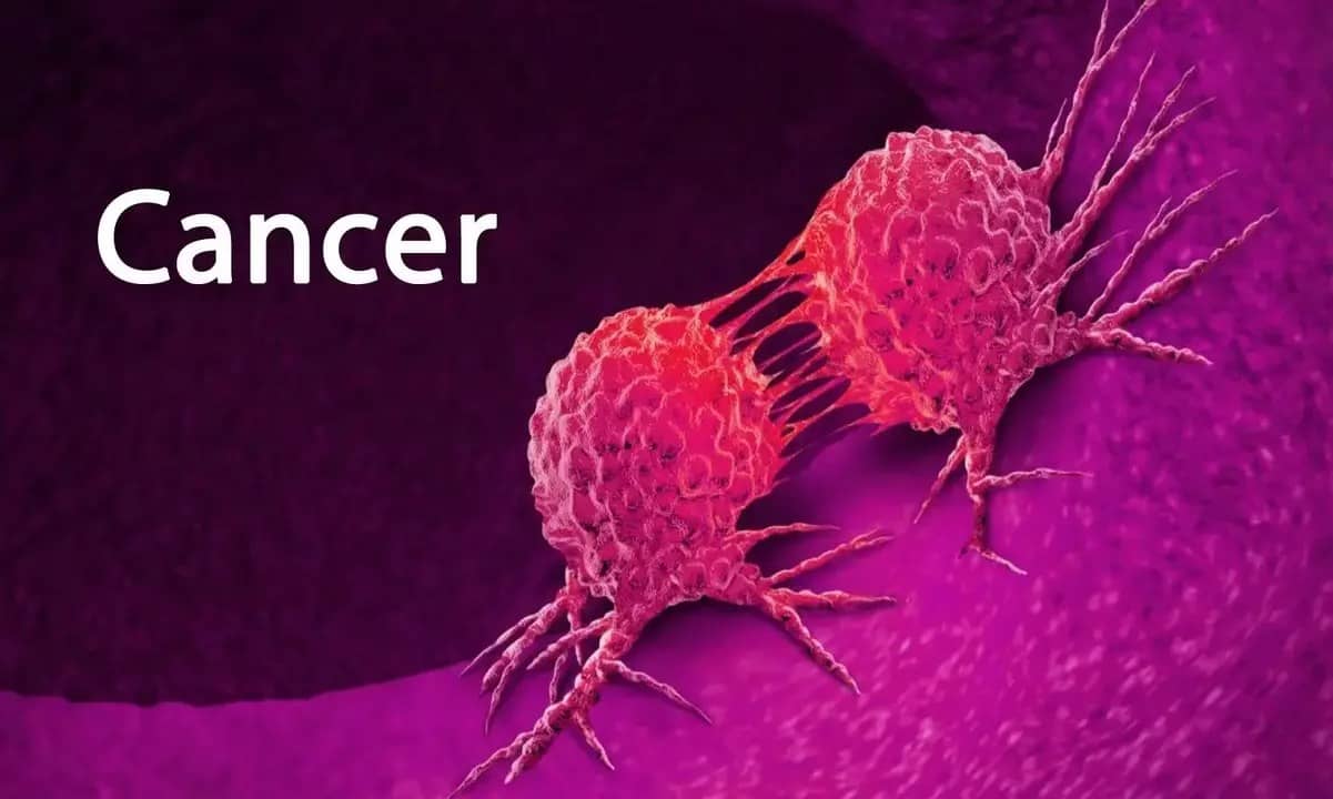 Fight Cancer with 6 Proven Strategies: Protect Your Health with Less Sitting and More Movement
