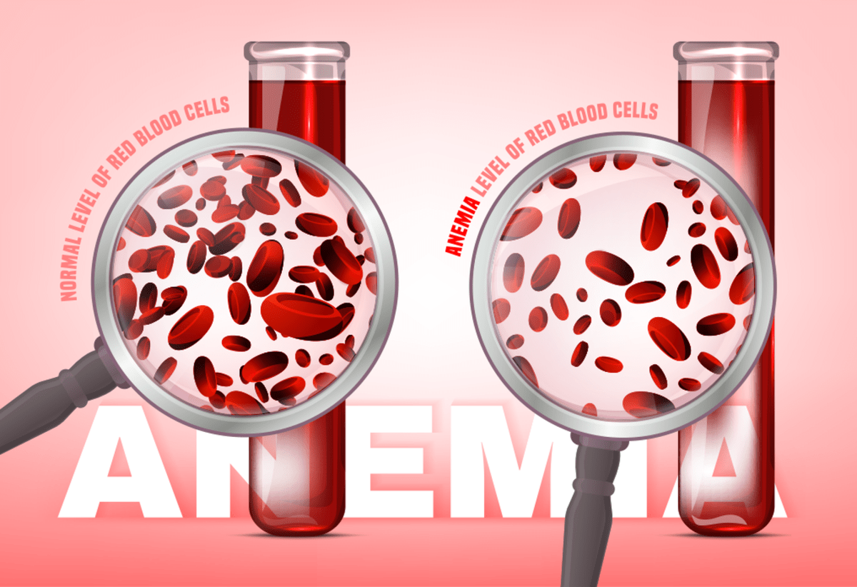 Prevent Anemia - 10 Impressive Health Benefits of Dates: A Nutritious and Delicious Superfood